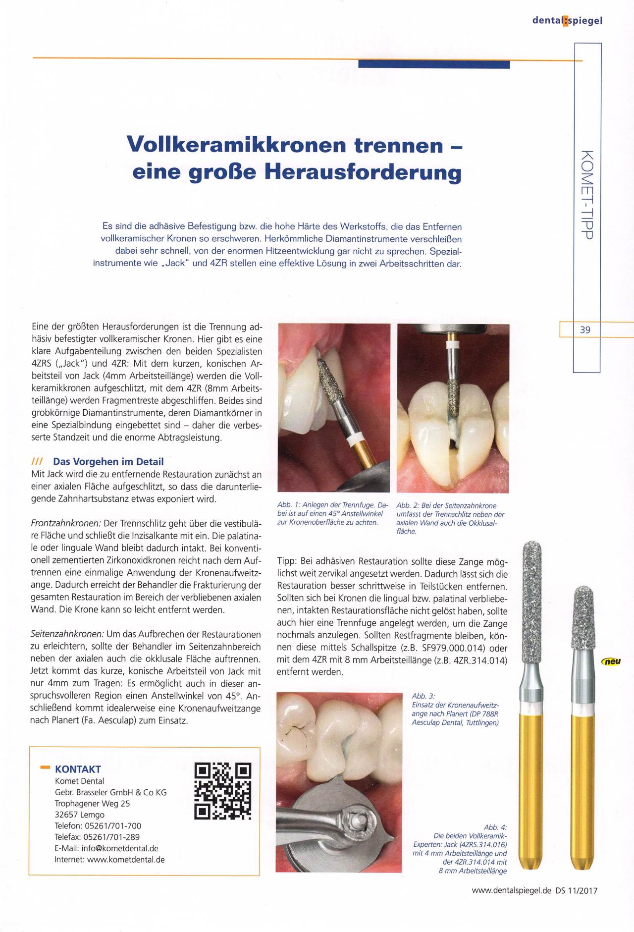 komet-dental-diao-tipp-2017-11-endo-restart-revision-wurzelkanal image 1