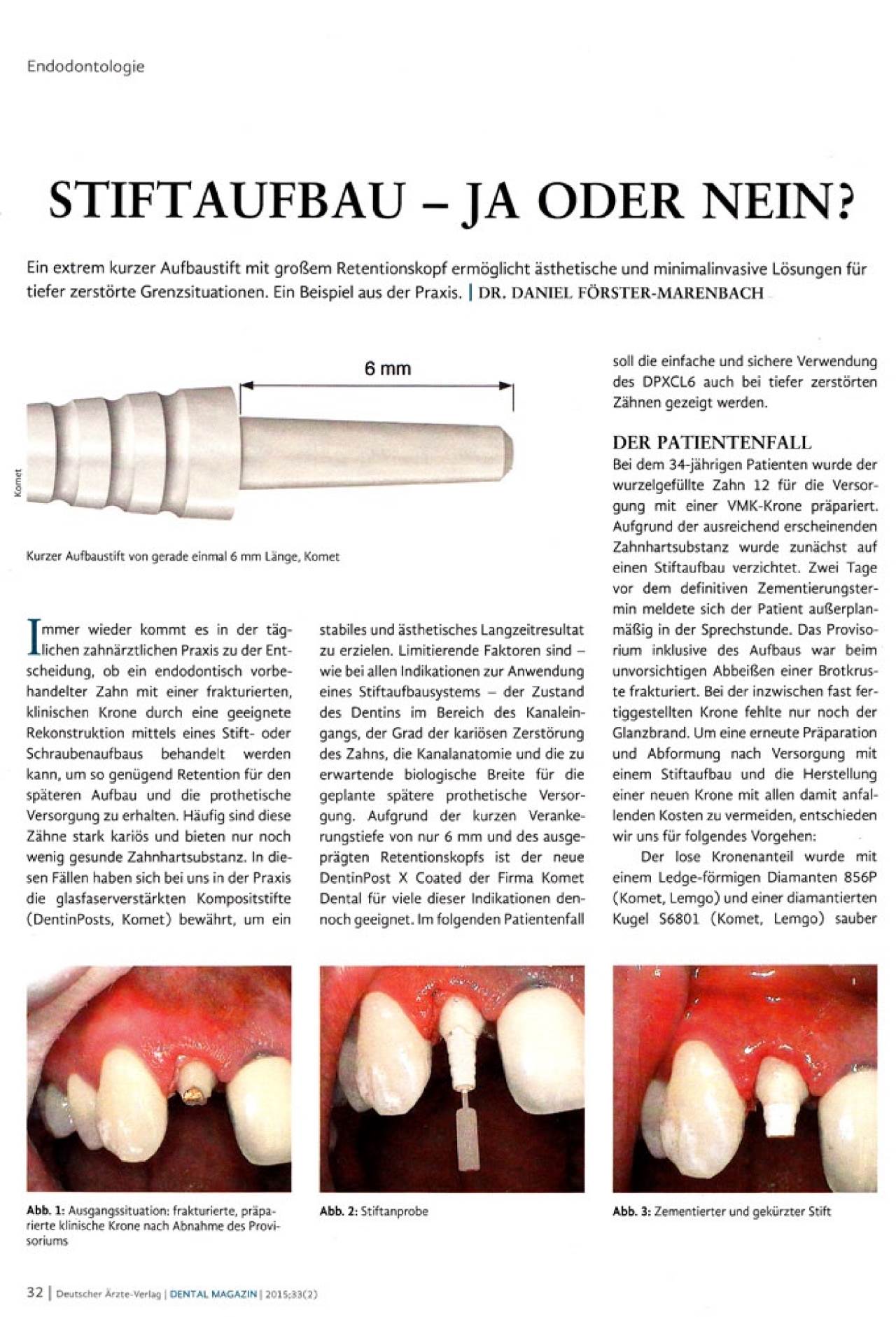 komet-dental-cerapost-stiftaufbau-wurzelstift-kurzer-stift image 1