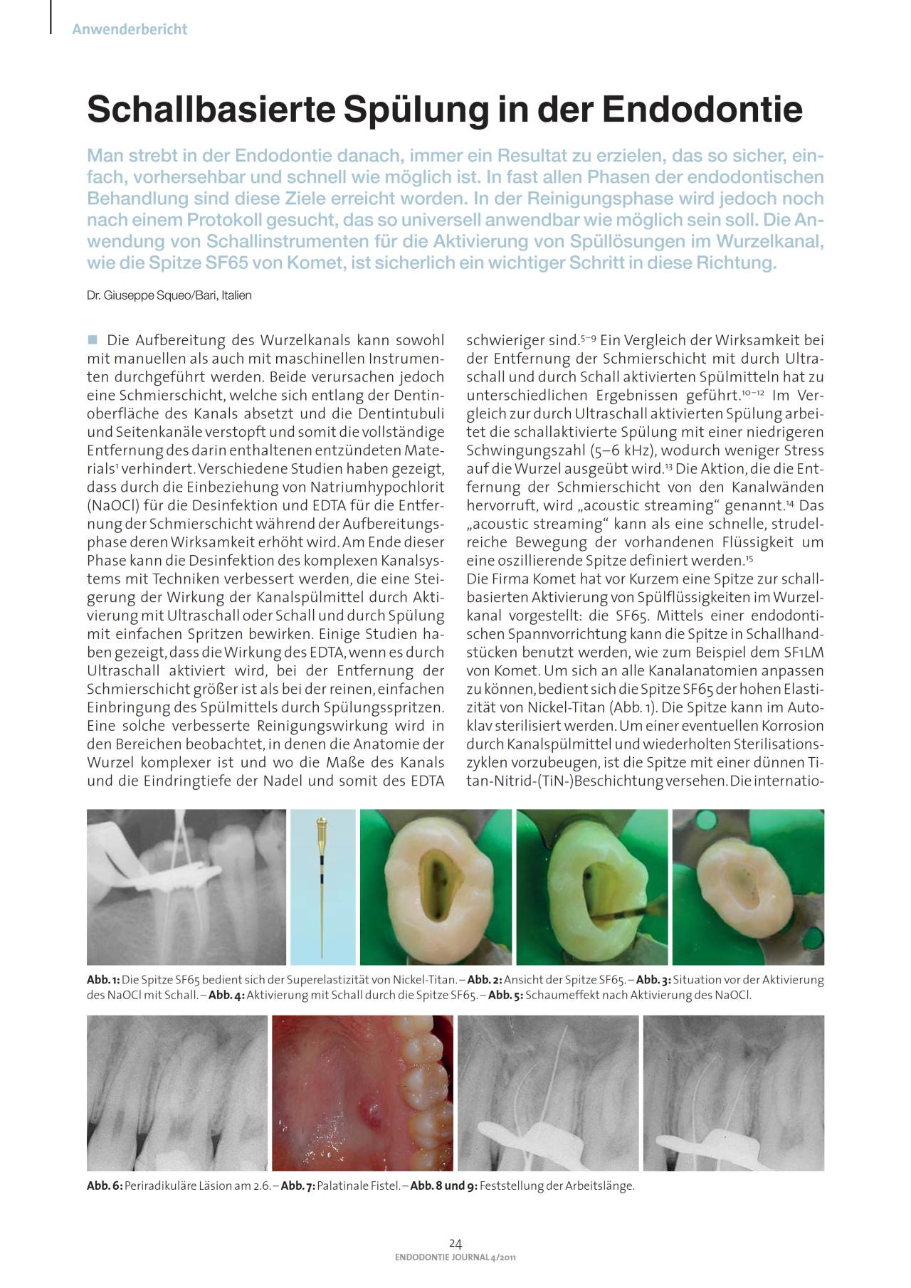 komet-dental-sonicline-fachbericht-sf65-endo-sp-lung image 1