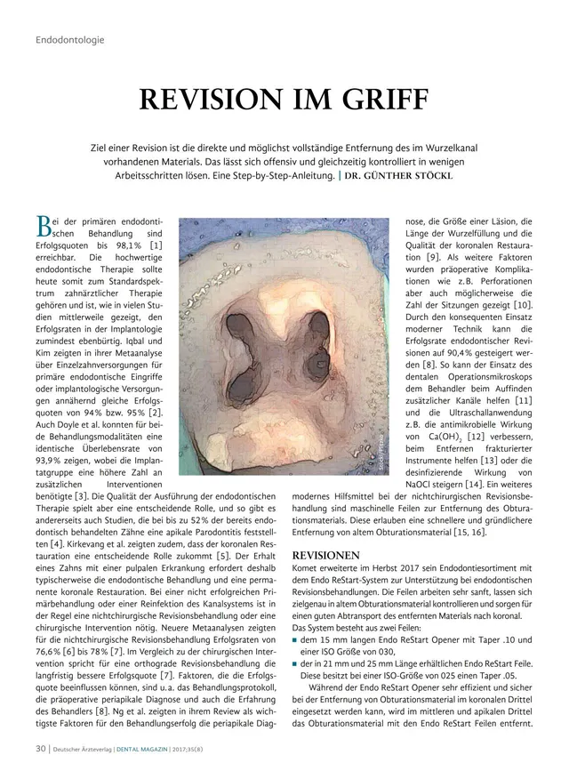 komet-dental-fq-fachbericht-revision-im-griff-step-by-step image 1