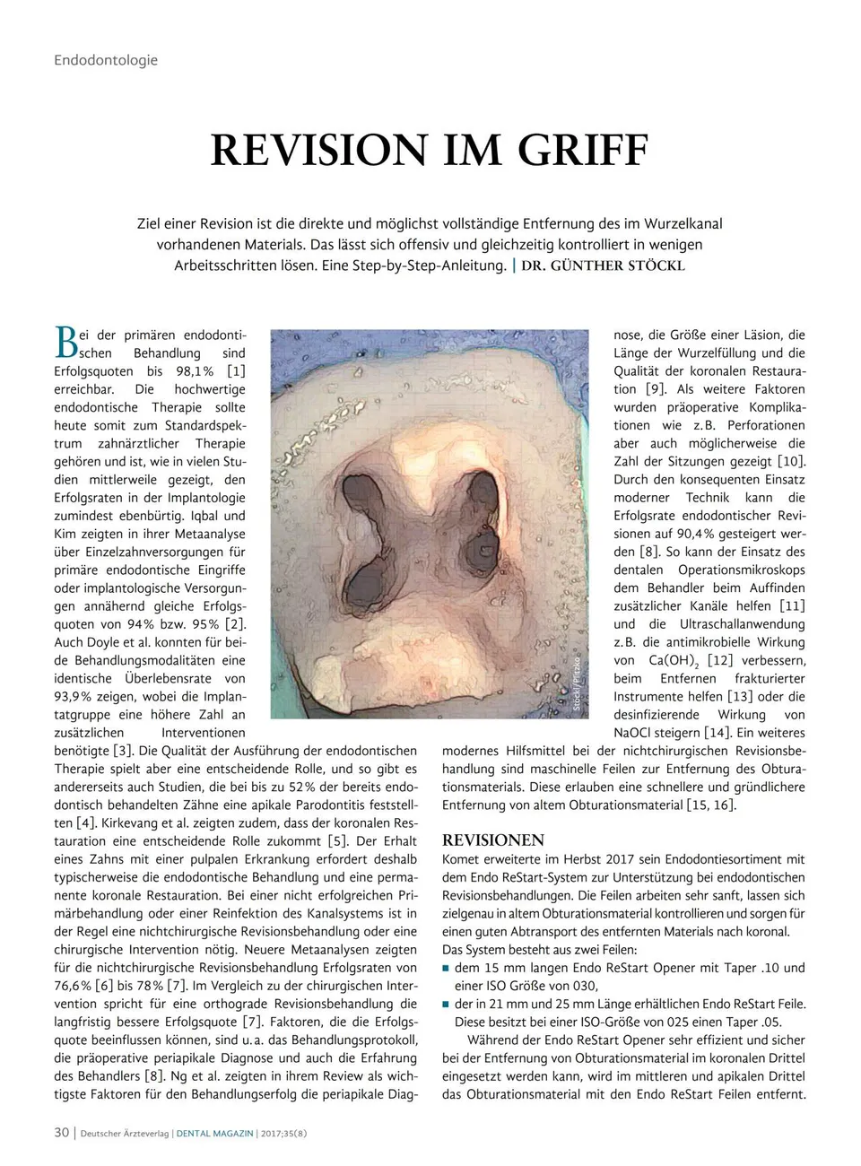 komet-dental-fq-fachbericht-revision-im-griff-step-by-step image 1