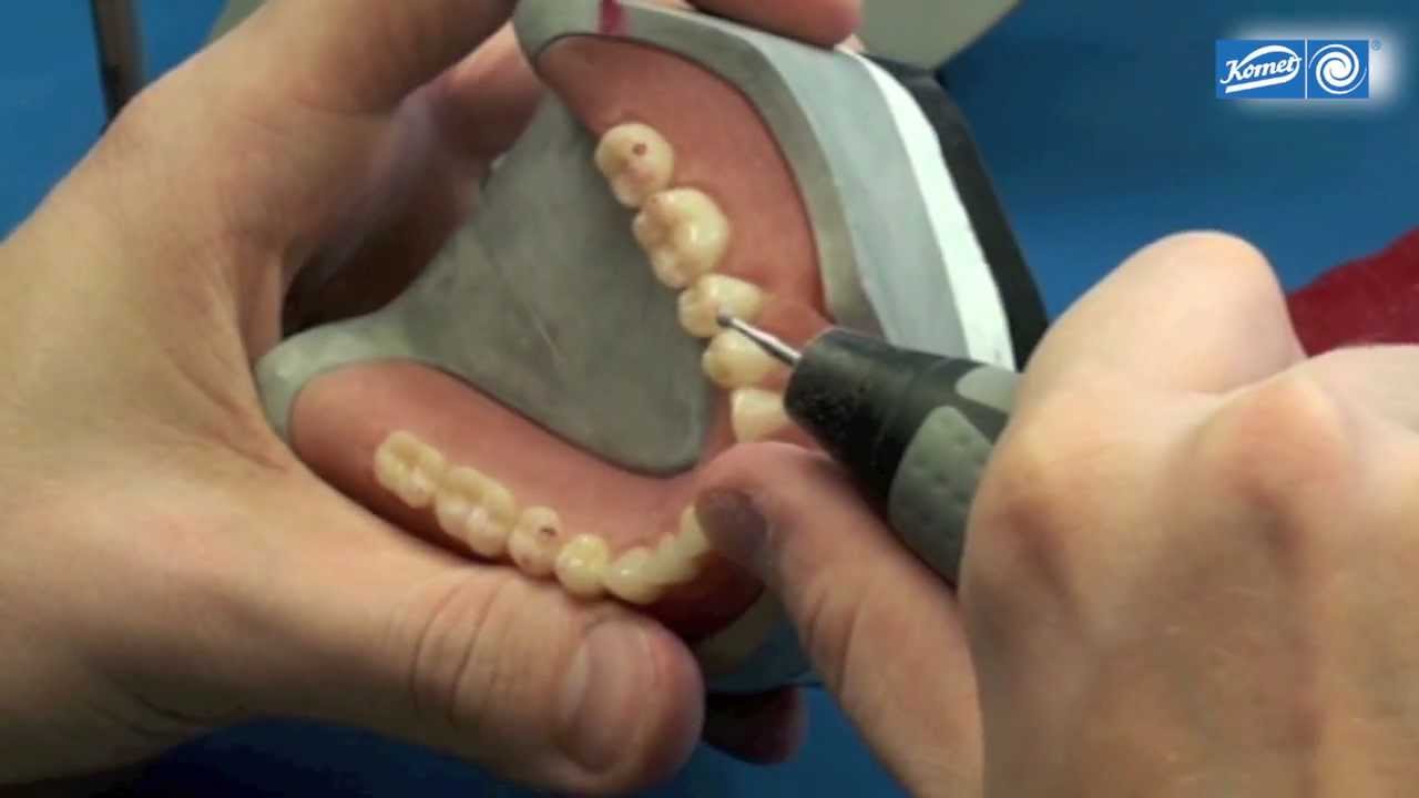 komet-dental-shax-video-kunststoff-prothese-ausarbeitung image 1