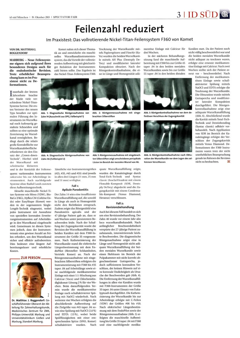 komet-f360-feile-wurzelkanalfeile-niti-2-feilen-system image 1