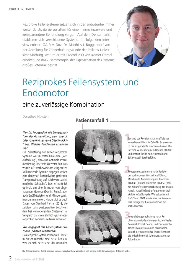 komet-dental-bioseal-fachbericht-biokeramische-sealer-interview image 1
