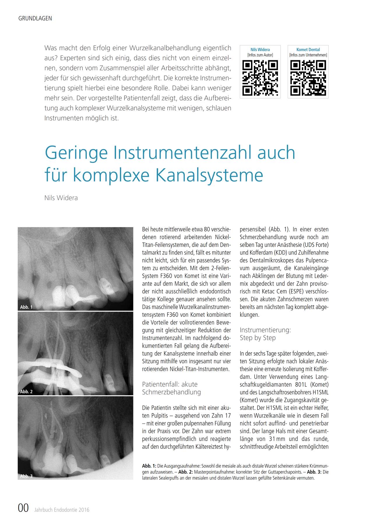 komet-diao-kanalsysteme-fachbericht-widera-2016 image 1