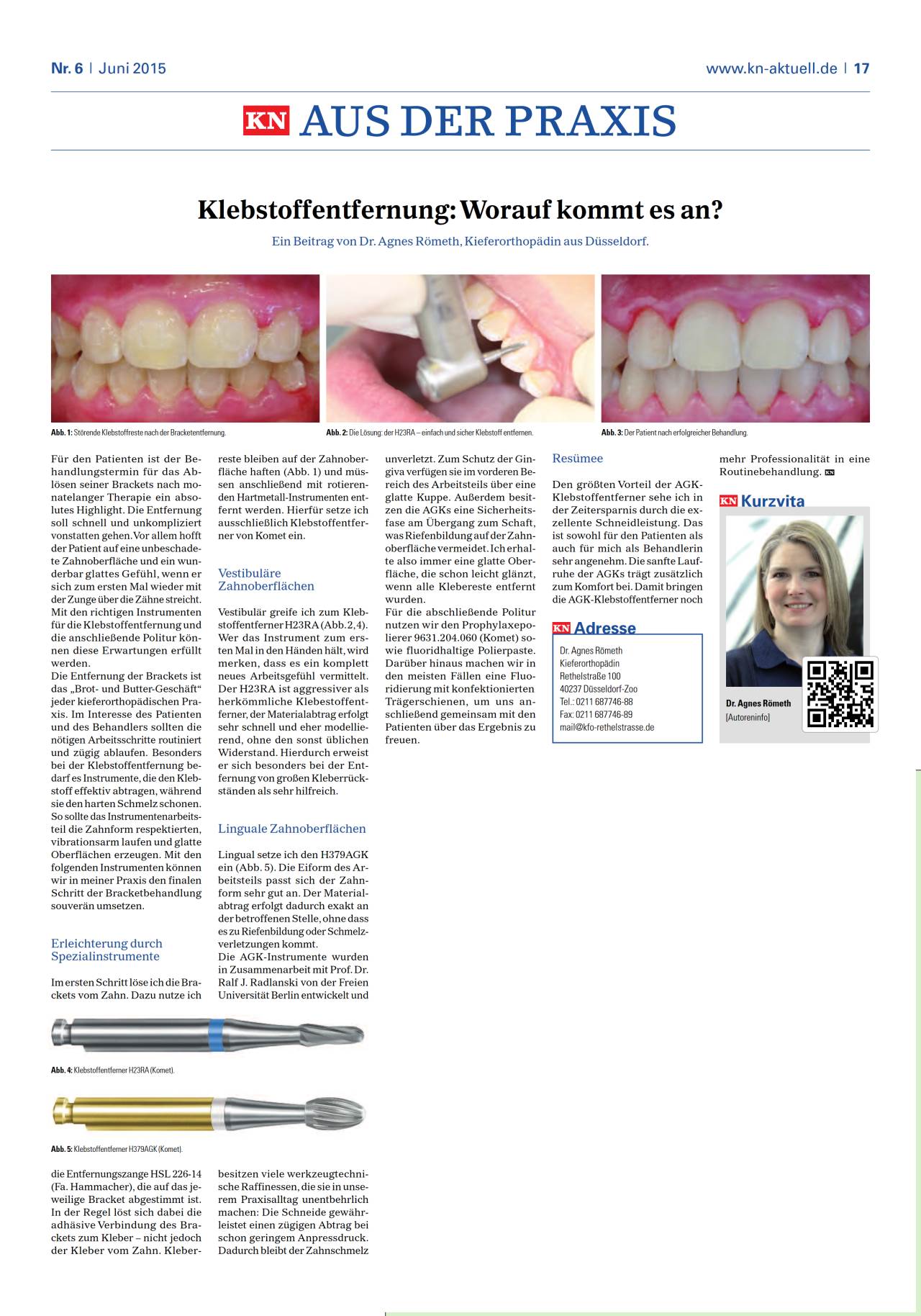 komet-diao-fachbericht-klebstoffentfernung-pdf image 1