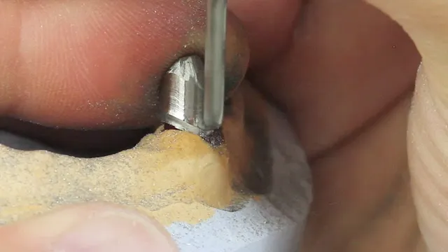 komet-dental-shax-nem-prim-rteil-fr-ser-teleskop image 1