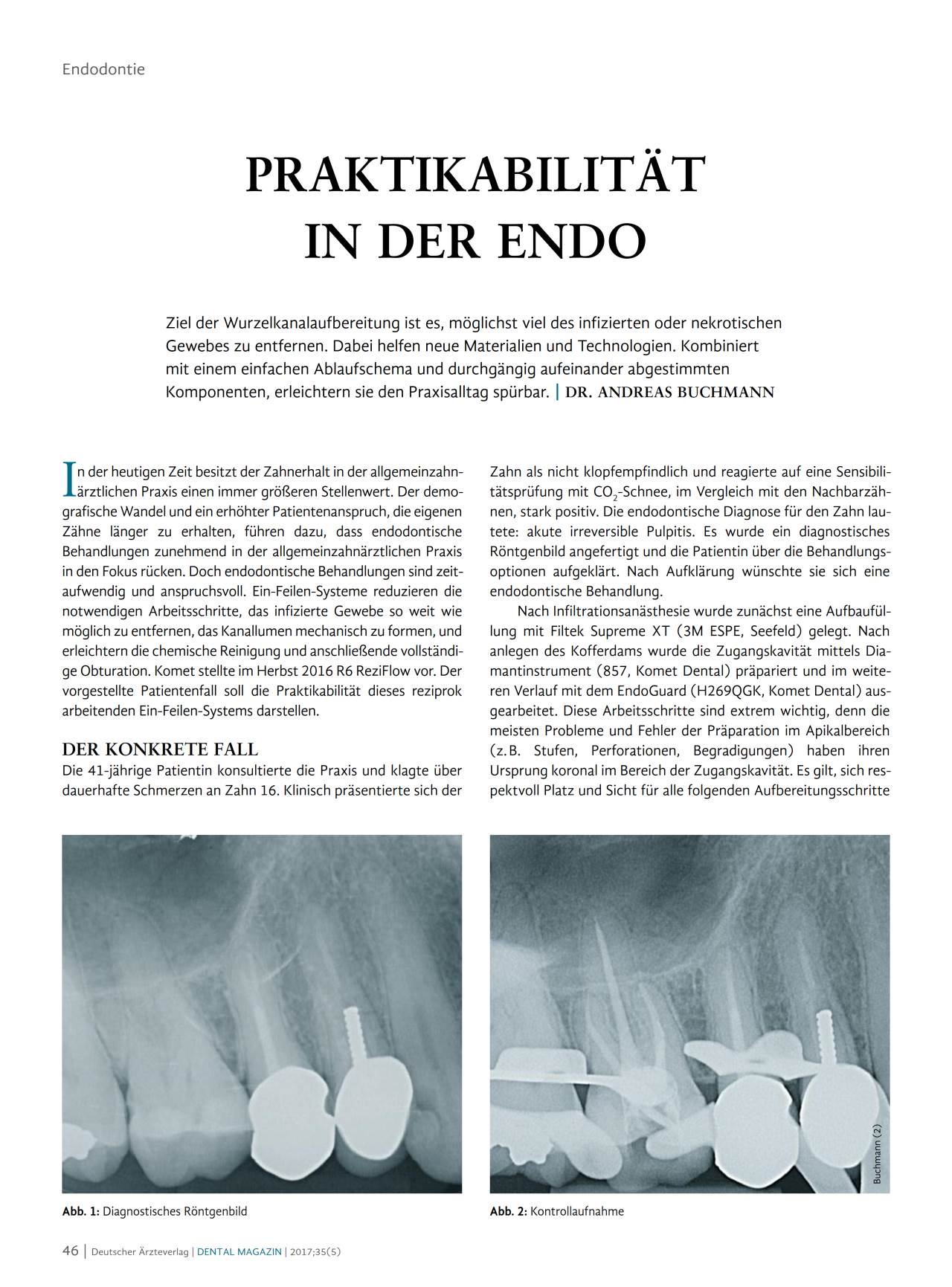 komet-fq-endo-fachbericht-wurzelkanalaufbereitung-06-2017 image 1