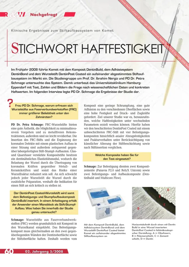 komet-ceracut-fachbericht-composite-stiftaufbau image 1