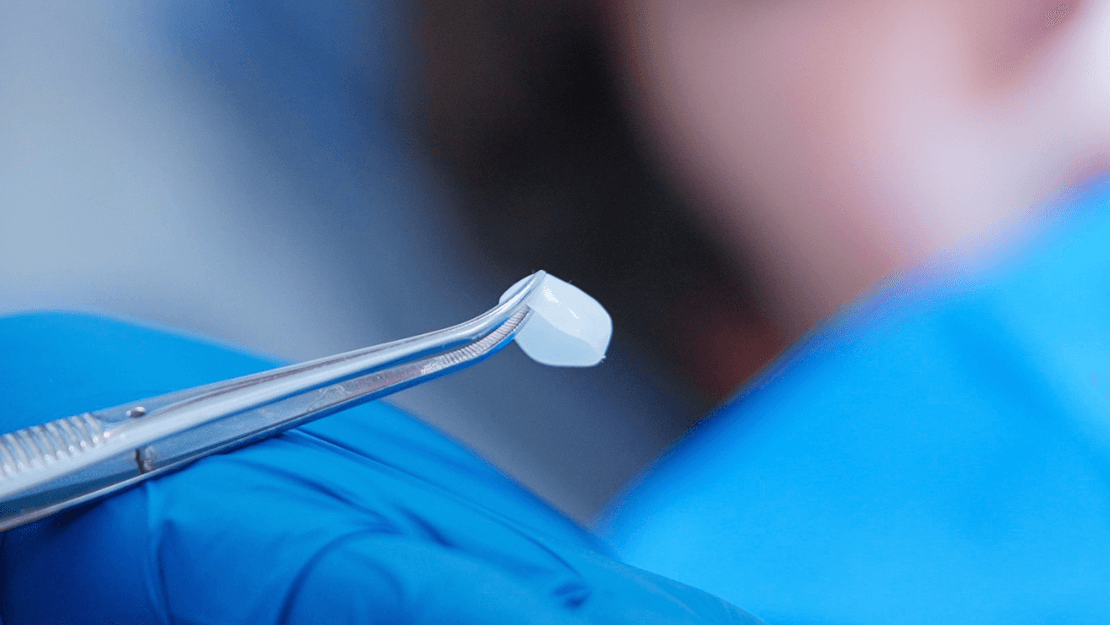 luxator-ceramir-pediatric-crowns-milchzahnkrone-f-r-kinder image 1