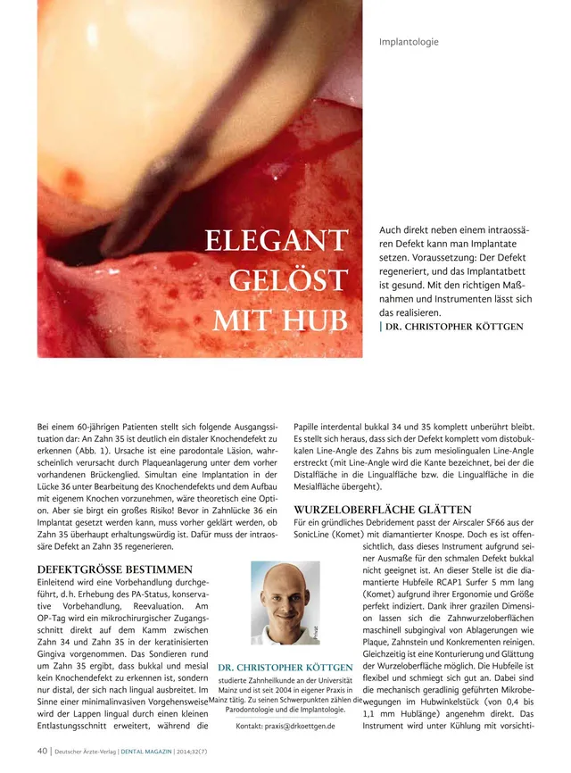 komet-diao-elegant-gel-st-mit-hub-fachbericht-hubtechnik image 1