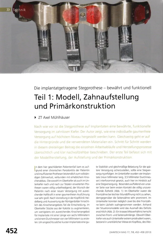 komet-shax-fachbericht-zahnaufstellung-prim-rkonstruktion image 1