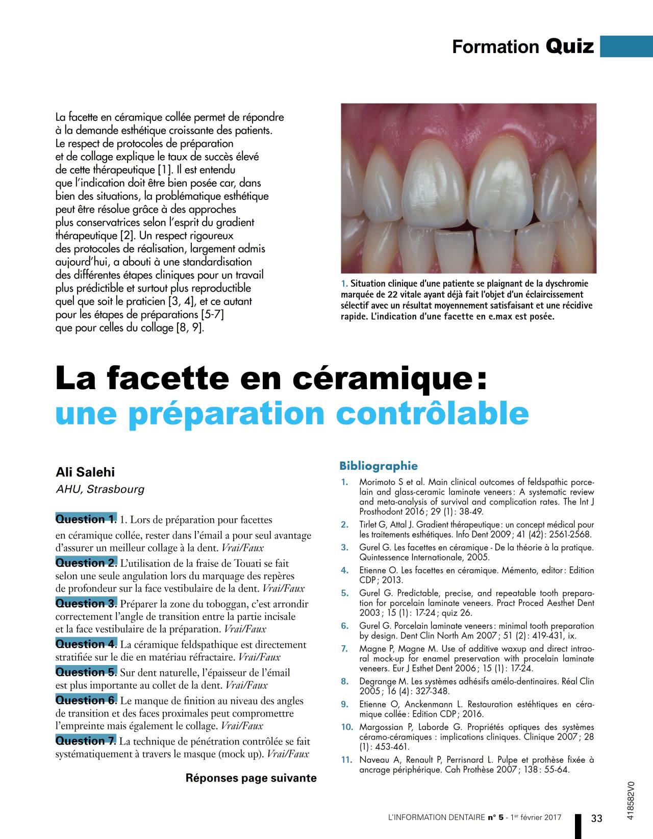 komet-diao-veneer-pr-parationsset-keramikfacetten-dr-salehi image 1