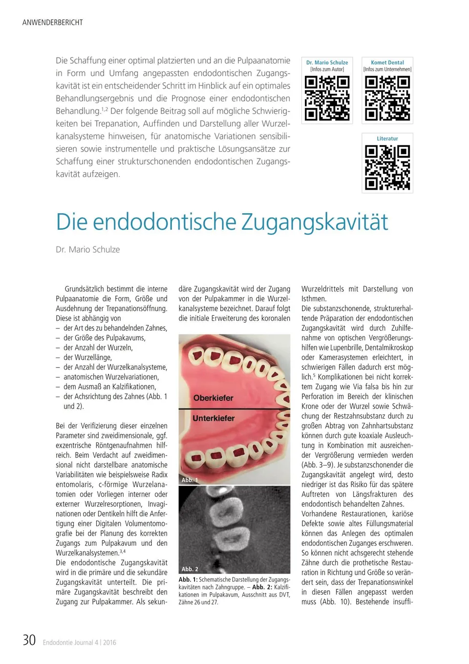 komet-fq-fachbericht-endodontische-zugangskavit-t-trepanation image 1