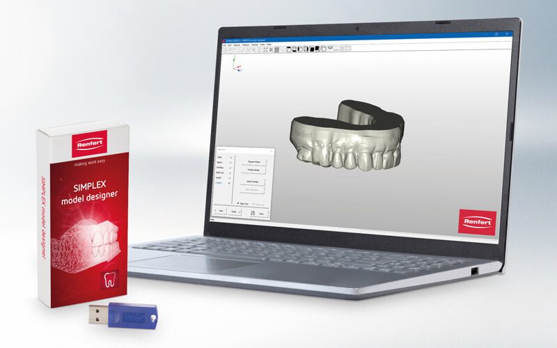 forestadent-simplex-3d-filament-drucksystem-in-house-aligner image 3