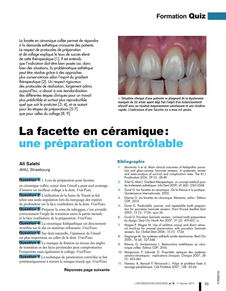komet-diao-veneer-pr-parationsset-keramikfacetten-dr-salehi image 1