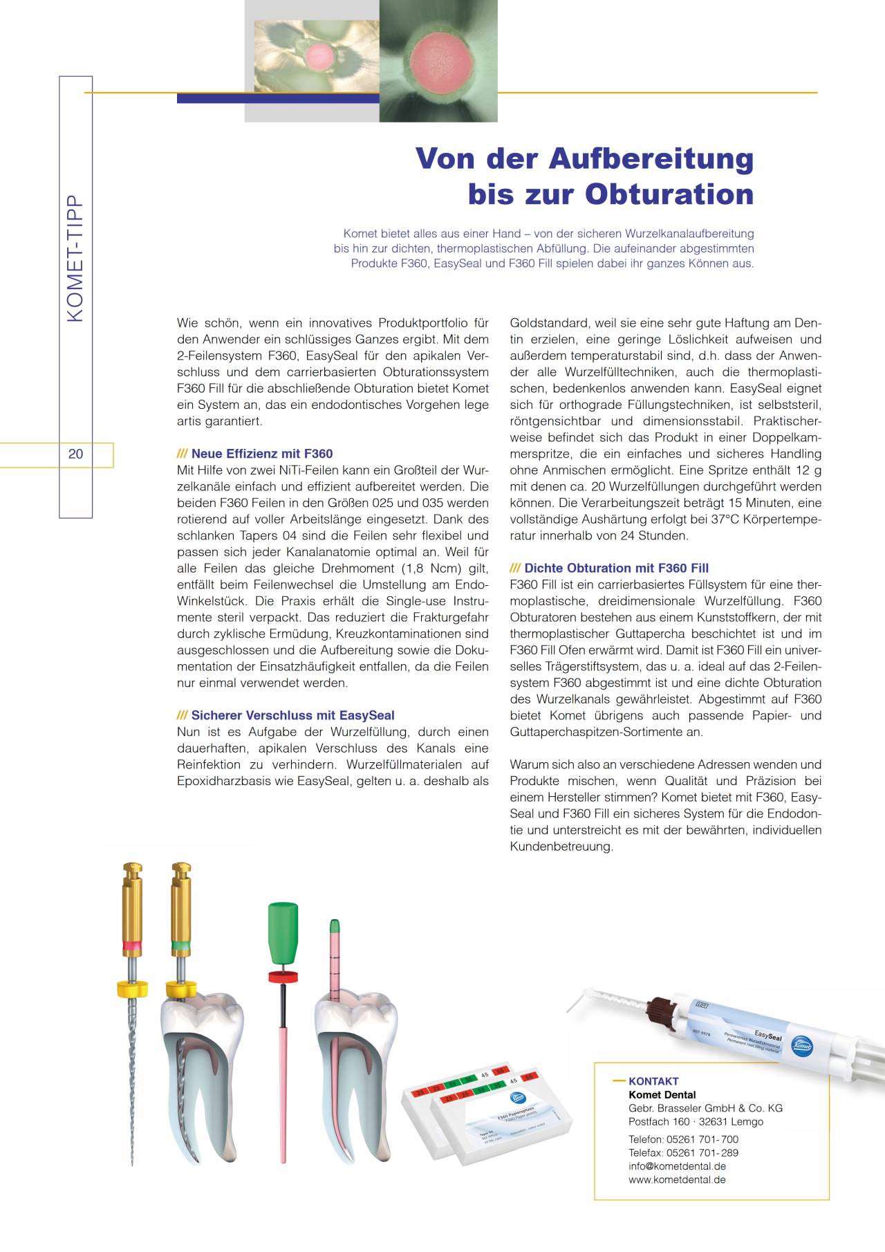 komet-diao-tipp-2013-01-f360-easyseal-obturation image 1