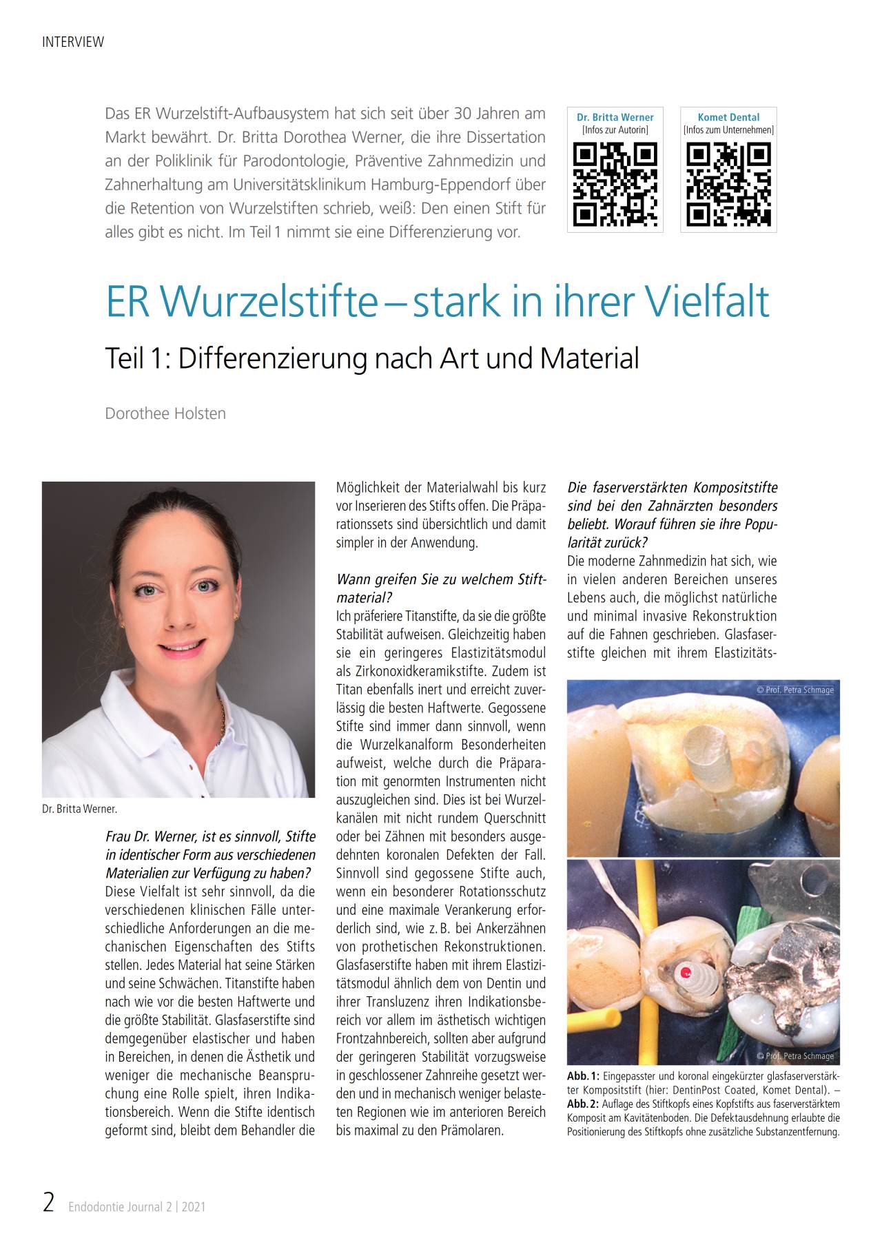 komet-dental-er-system-fachbericht-wurzelstifte-teil-1 image 1