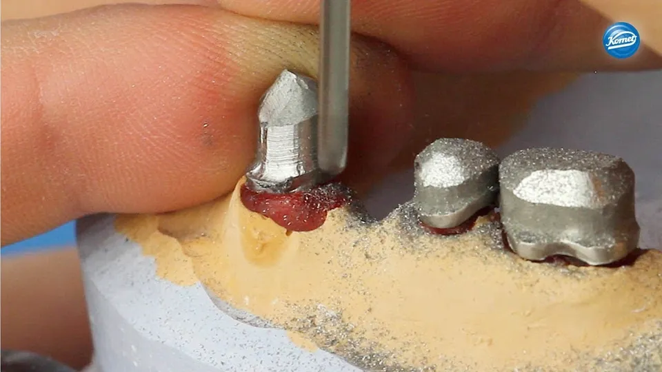 komet-dental-diao-video-nem-prim-rteile-unterkiefer-schulung image 1