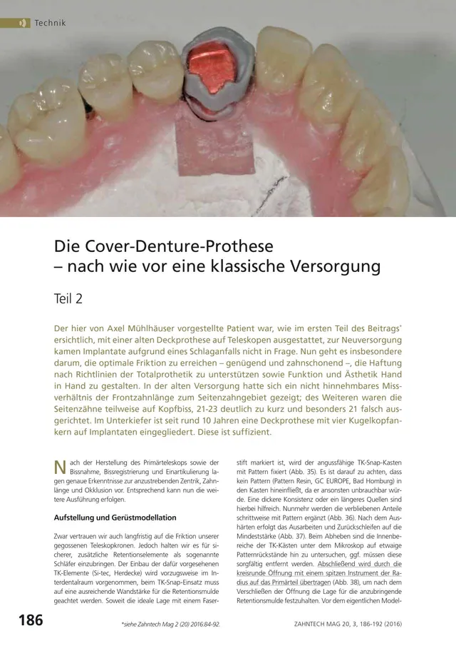 komet-dental-shax-laborfr-ser-cover-denture-prothese-set image 1
