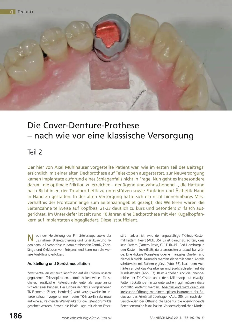 komet-dental-shax-laborfr-ser-cover-denture-prothese-set image 1
