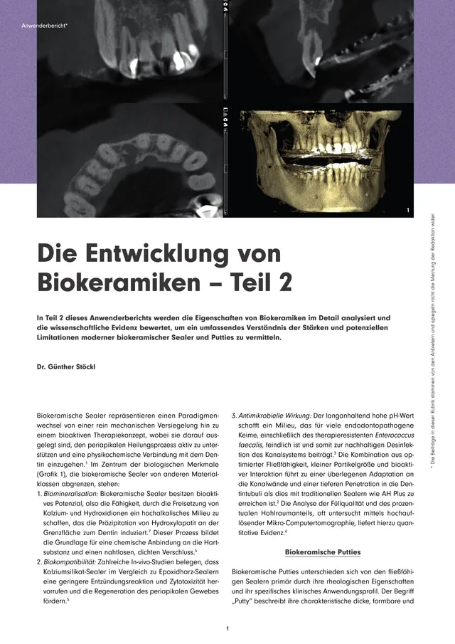 komet-bioseal-fachbericht-biokeramiken-teil-2-endo image 1