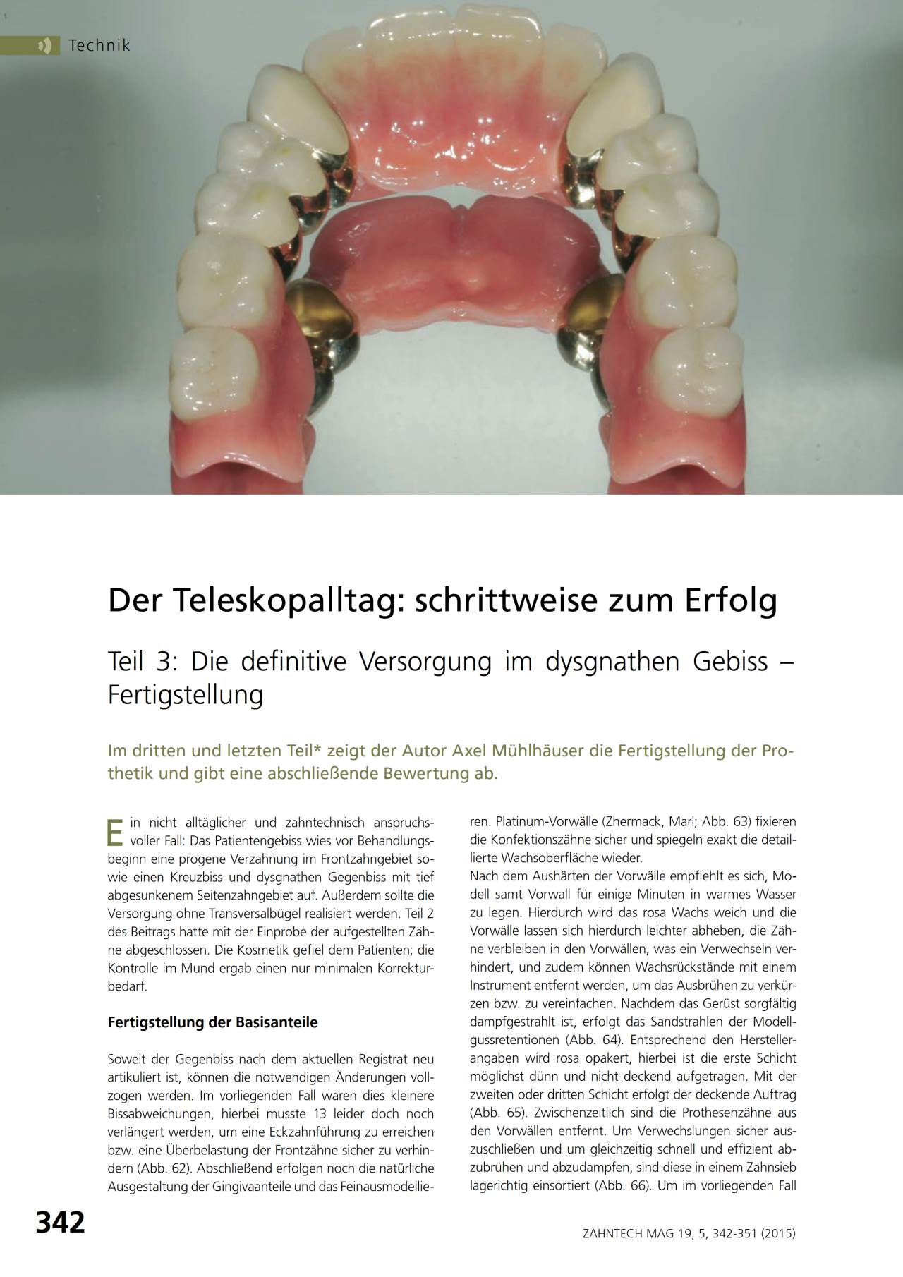 komet-dental-diao-fachbericht-teleskop-versorgung-m-hlh-user image 1