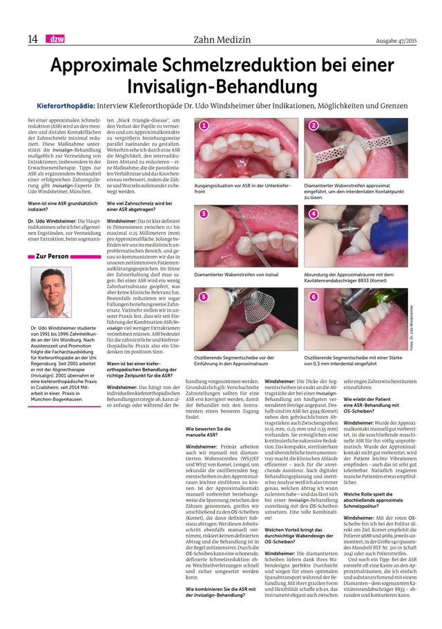 komet-diao-fachbericht-schmelzreduktion-invisalign image 1