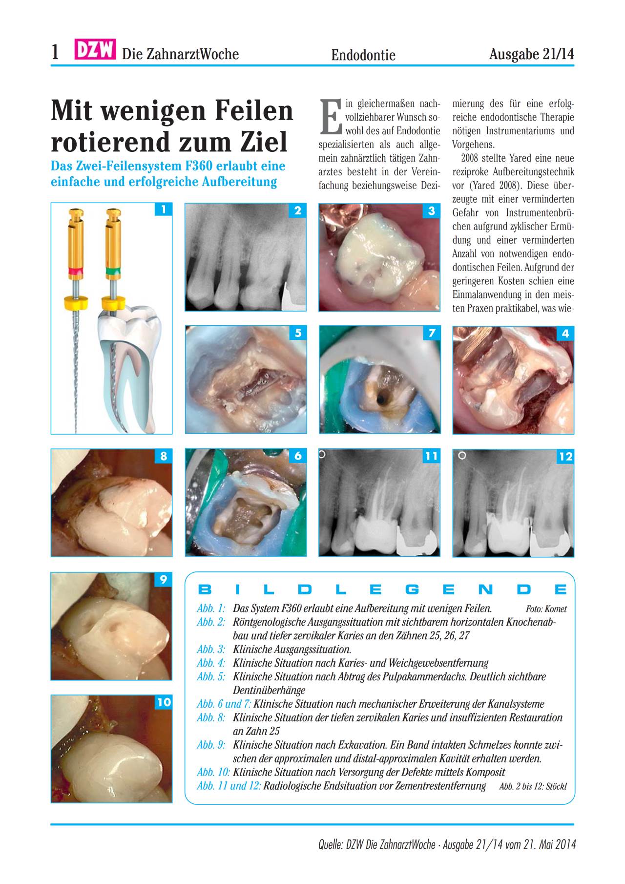 komet-dental-fq-fachbericht-f360-mai-2014 image 1