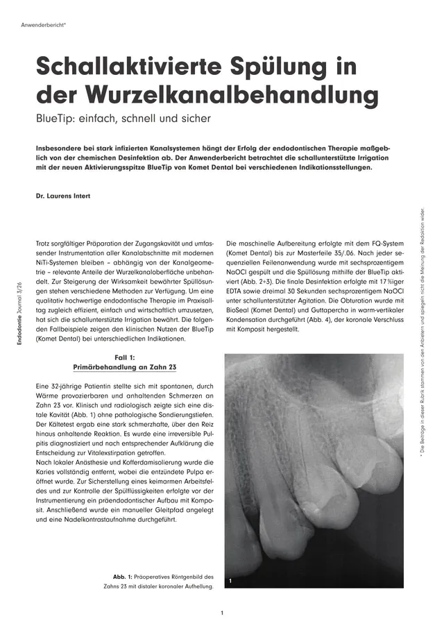 komet-sonicline-fachbericht-schallaktivierte-sp-lung-ej-08-2026 image 1
