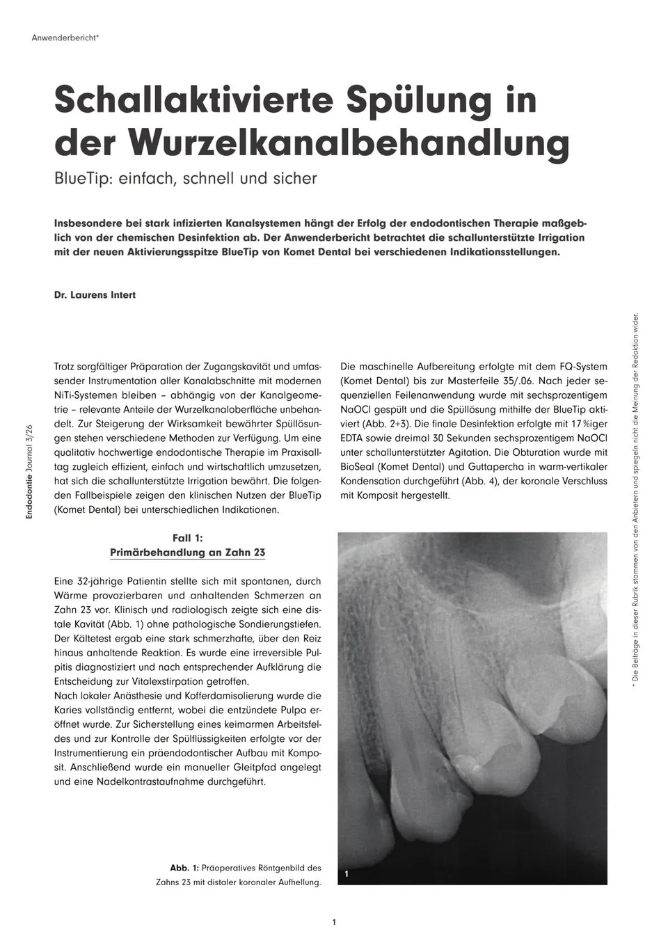 komet-sonicline-fachbericht-schallaktivierte-sp-lung-ej-08-2026 image 1