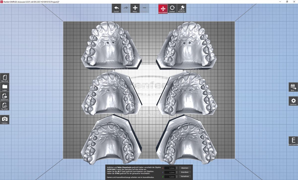 forestadent-simplex-3d-filament-drucksystem-in-house-aligner image 4
