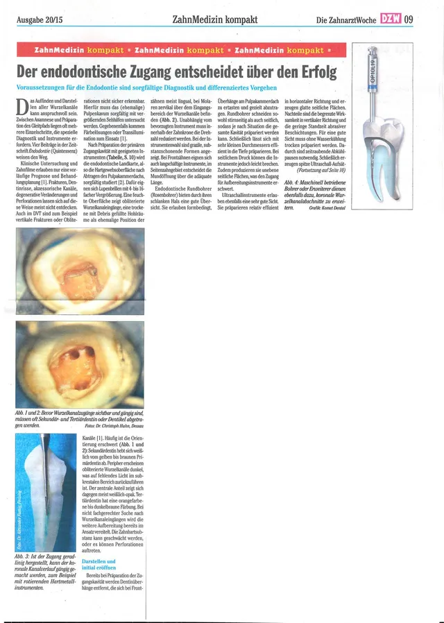 komet-dental-fq-fachbericht-endodontischer-zugang-dzw-20 image 1