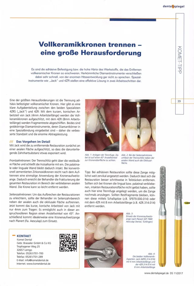 komet-dental-diao-tipp-2017-11-endo-restart-revision-wurzelkanal image 1