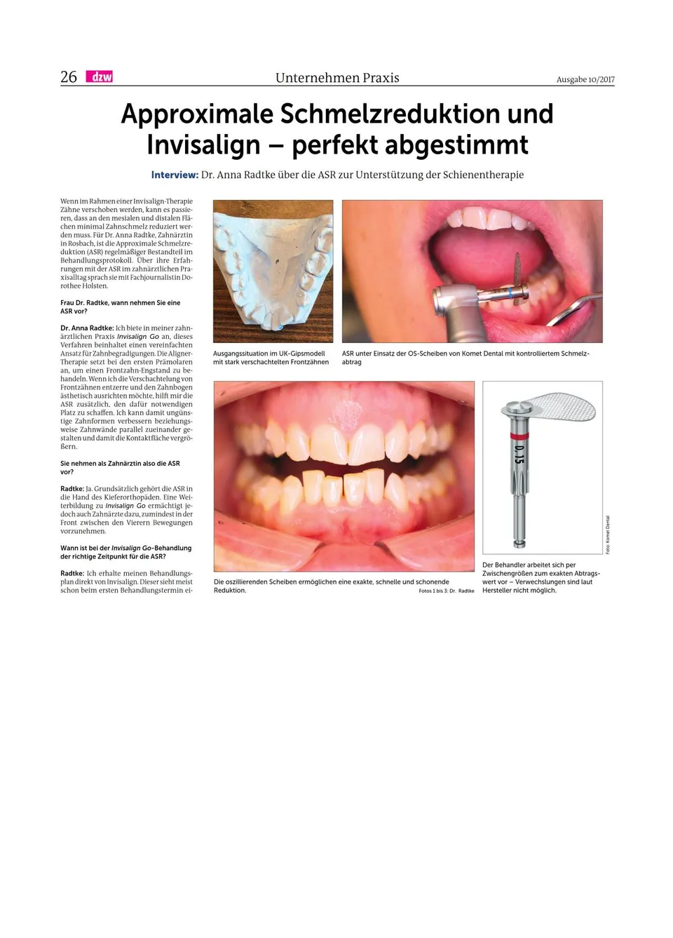 komet-diao-ipr-streifen-f-r-schmelzreduktion-invisalign image 1