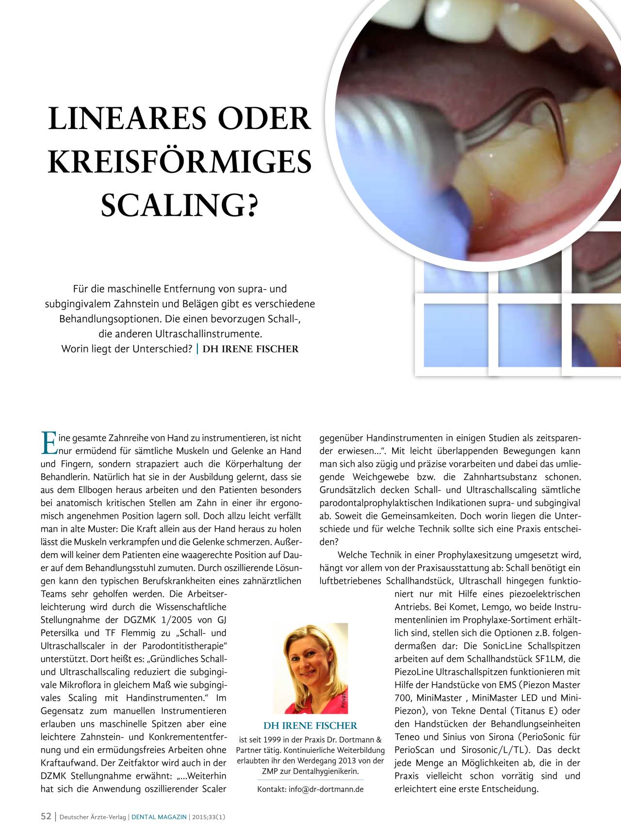 komet-dental-diao-scaling-fachbericht-fischer-zahnstein image 1