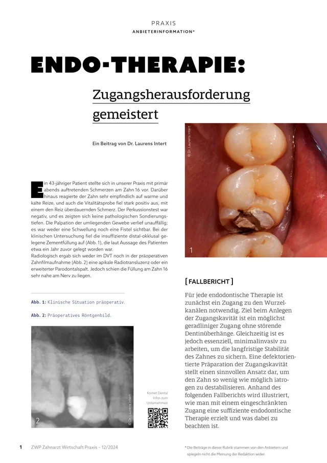 komet-diao-bohrer-endo-zugang-fachbericht-therapie image 1