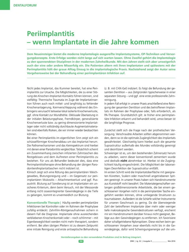 komet-ceradrill-fachbericht-periimplantitis-implantate image 1