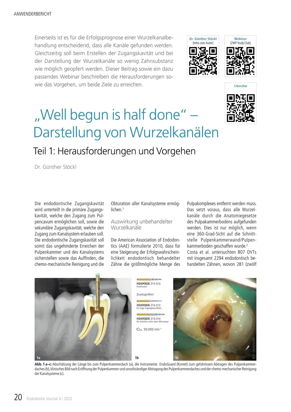 komet-dental-diao-fachbericht-wurzelkanal-darstellung image 1