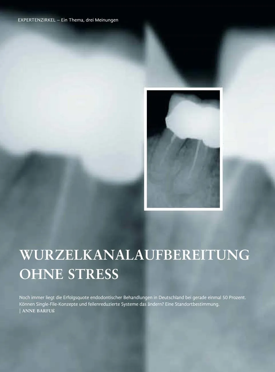 komet-dental-fq-fachbericht-wurzelkanalaufbereitung-stressfrei image 1