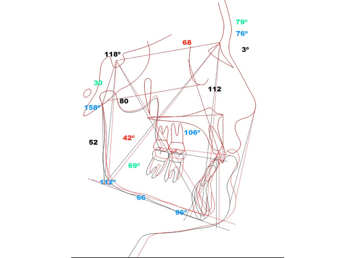 forestadent-fas-aligner-system-digitale-behandlungsplanung-wizard image 3