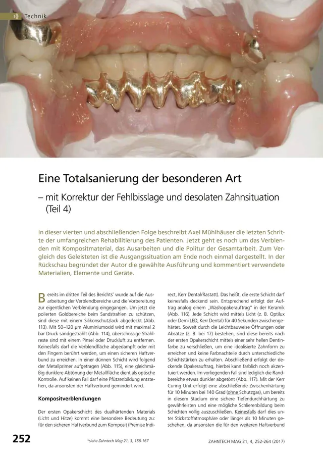 komet-diao-fachbericht-totalsanierung-fehlbisslage-teil-4 image 1