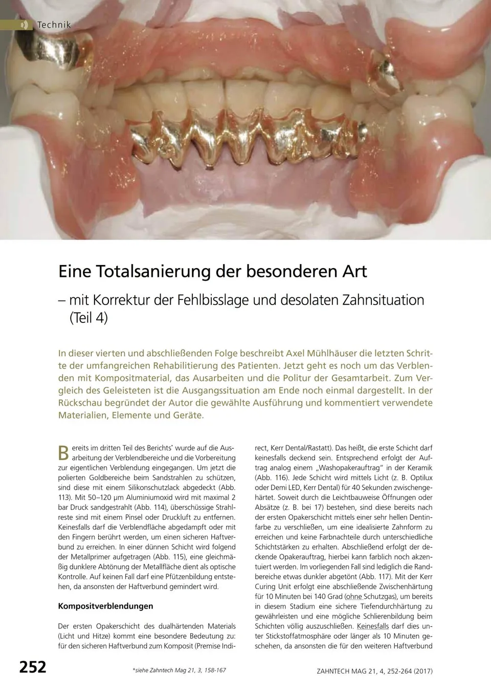 komet-diao-fachbericht-totalsanierung-fehlbisslage-teil-4 image 1