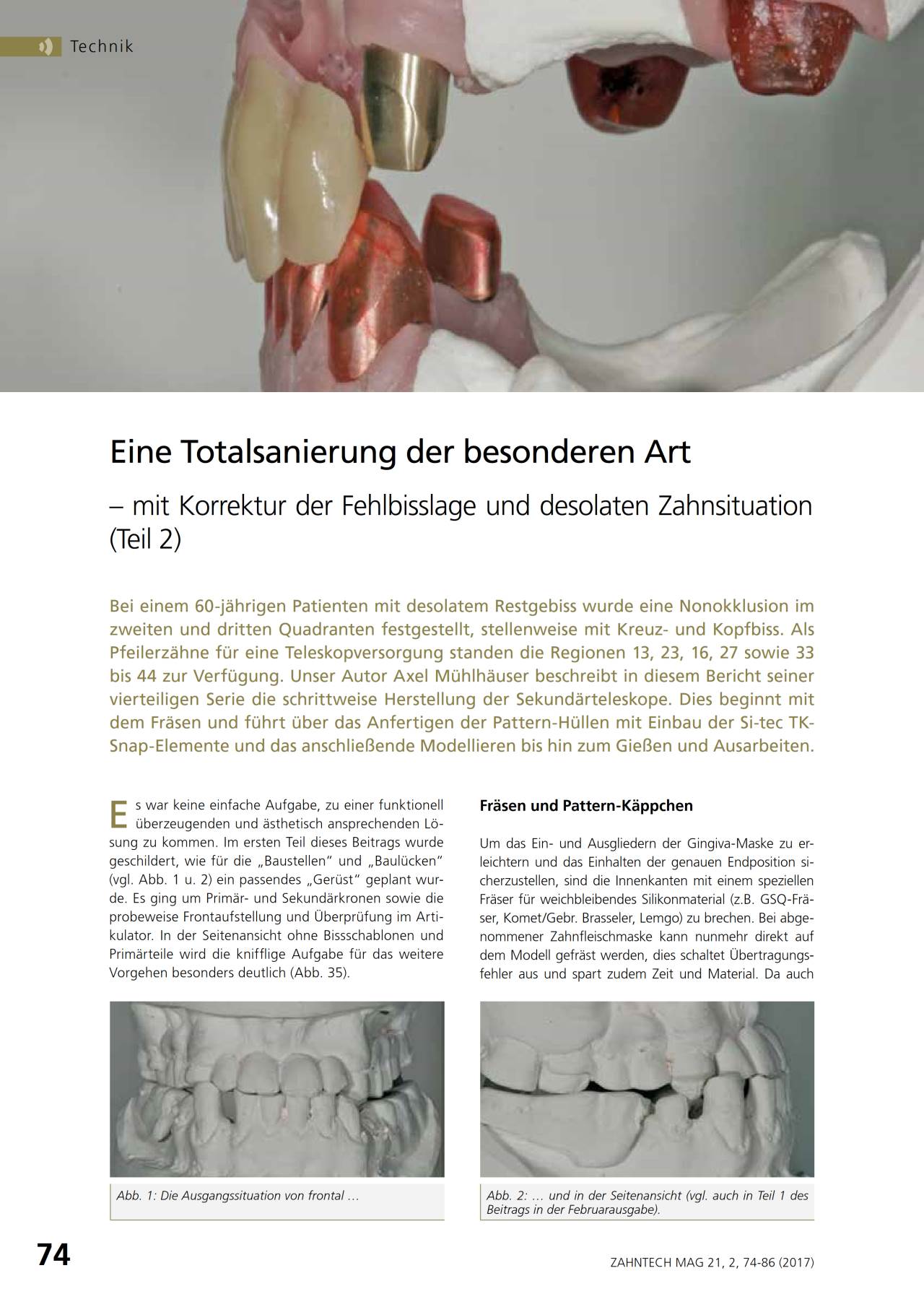 komet-dental-diao-fachbericht-totalsanierung-teil-2 image 1