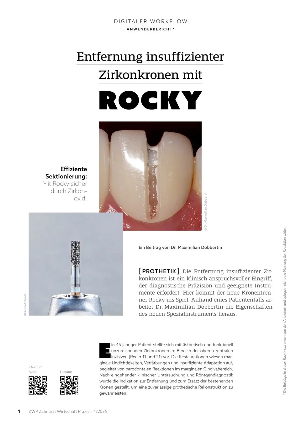 komet-rocky-zirkonkronen-fachbericht-dobbertin image 1