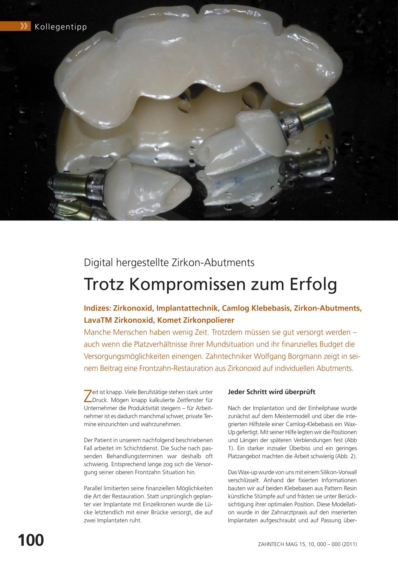 komet-dental-ceracut-fachbericht-zirkonoxid-bearbeitung-abutment image 1