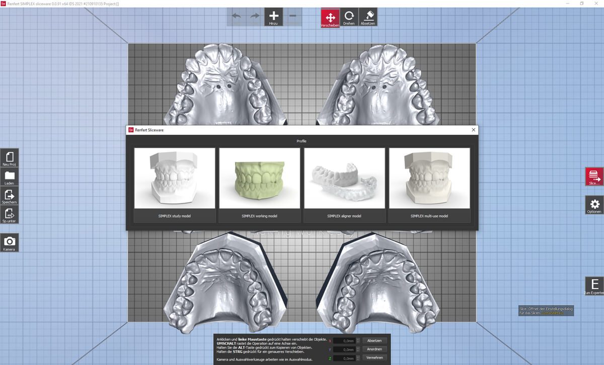forestadent-simplex-3d-filament-drucksystem-in-house-aligner image 5