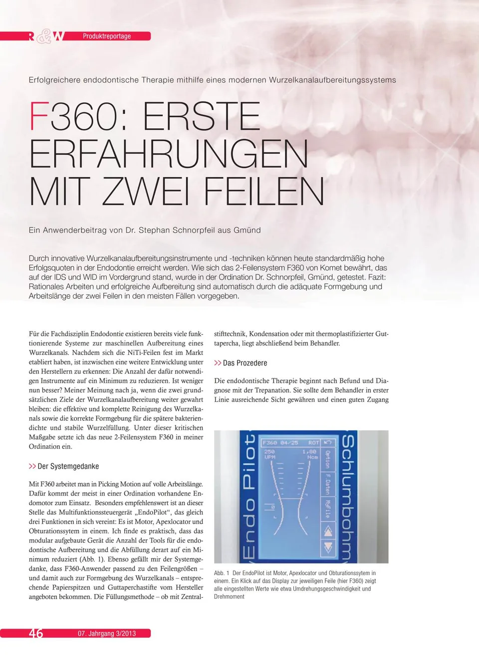 komet-dental-f360-wurzelkanalfeilen-niti-2-feilen-set image 1