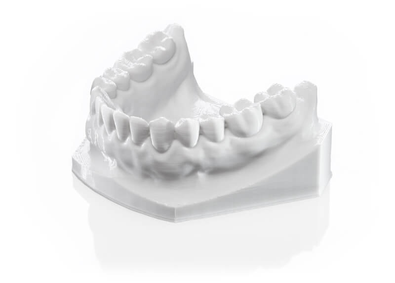 forestadent-simplex-3d-filament-drucksystem-in-house-aligner image 8