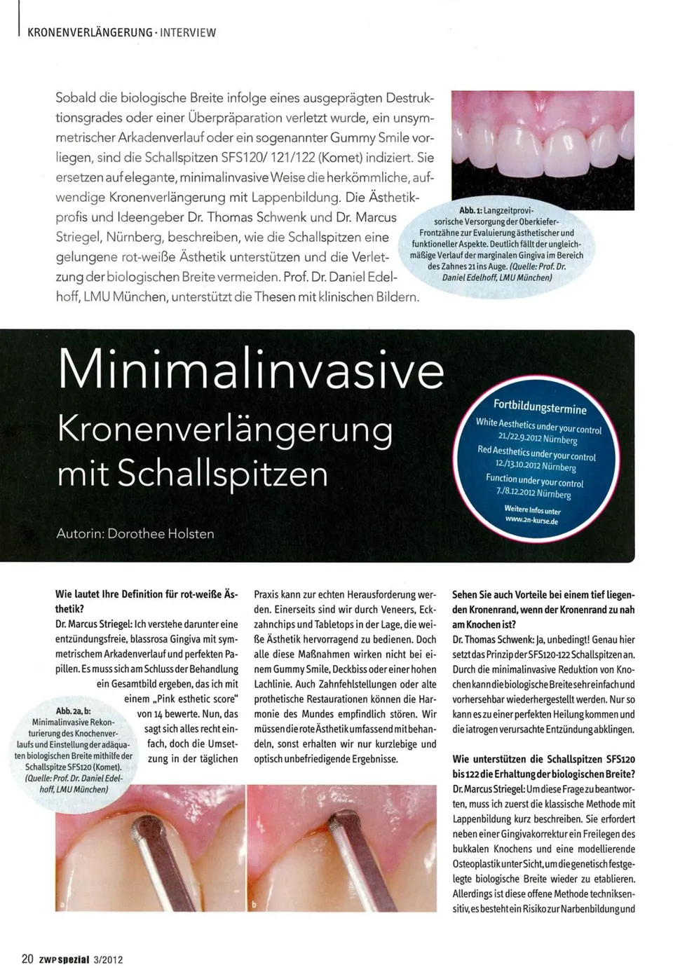 komet-diao-minimalinvasive-kronenverl-ngerung-fachbericht image 1
